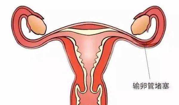 深圳需要卵子的联系 深圳北大医院推荐理由 ‘b超查男女的几个月准确率最高’