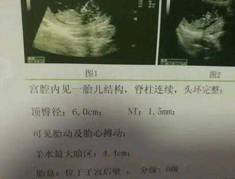深圳助孕医院排名 深圳北大医院第三代试管婴儿指南：流程、成功率、费用这
